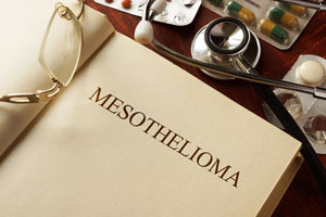 What Do I Need To Do To File A Mesothelioma Claim?